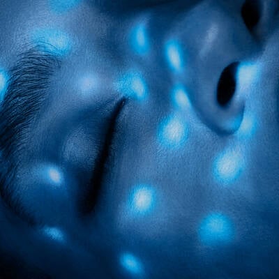 Blue light therapy for skin: benefits and what to expect