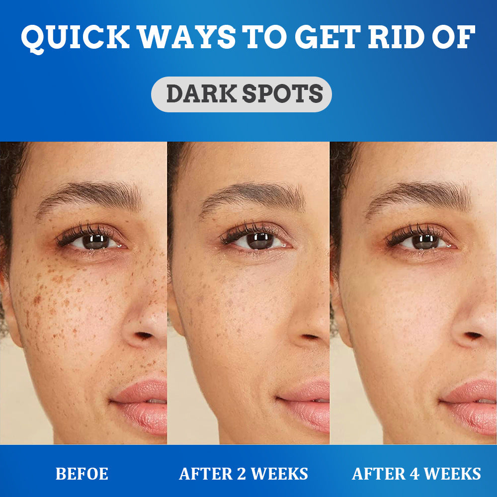 Crème anti tâches brune