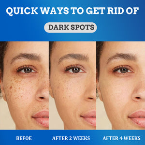 Crème anti tâches brune