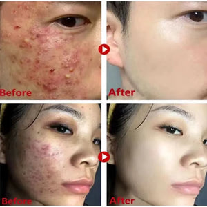 Masque stick anti-points noirs au thé vert